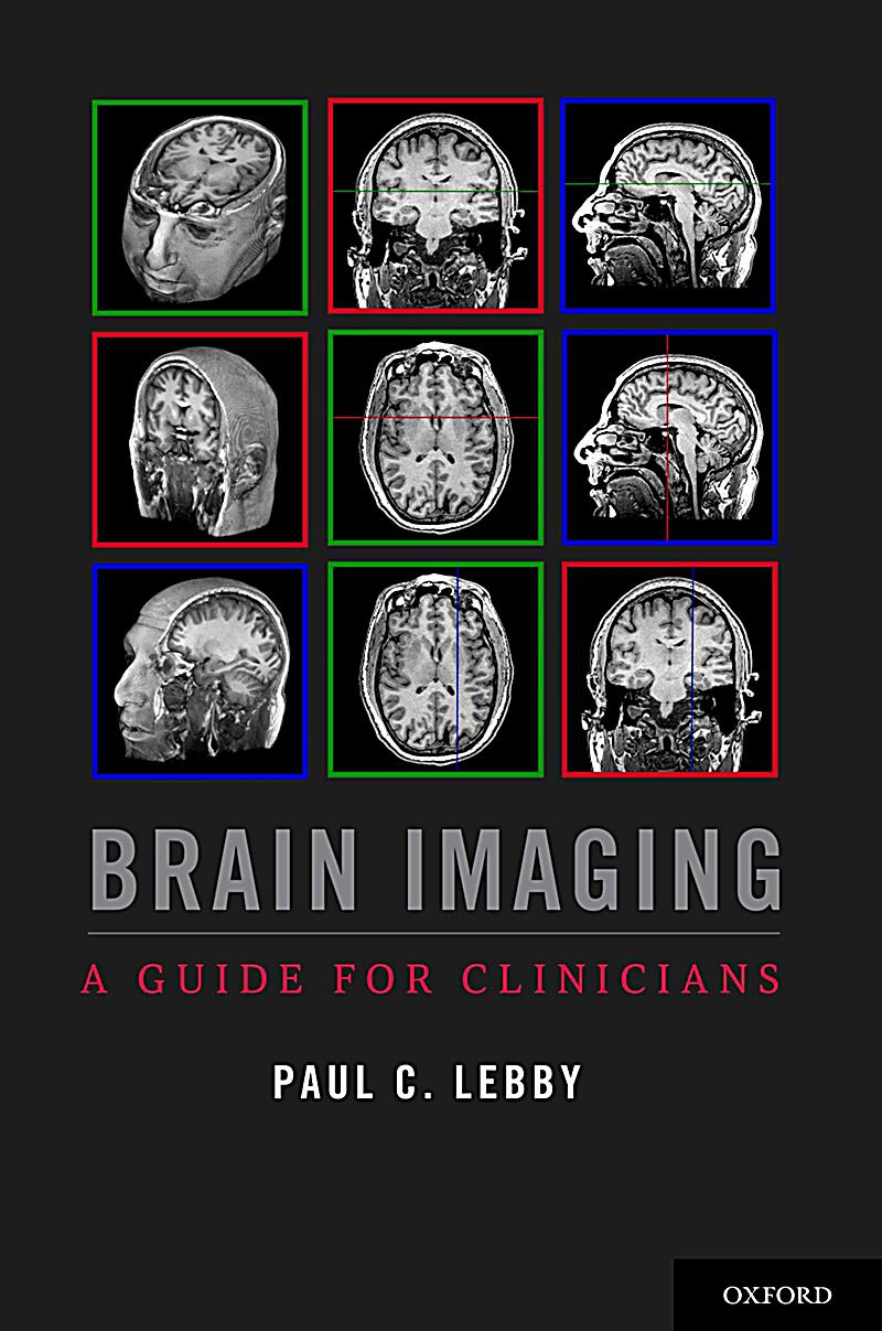 Brain Imaging