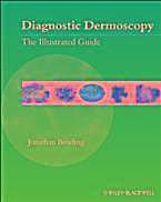 Diagnostic Dermoscopy