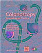 Colonoscopy