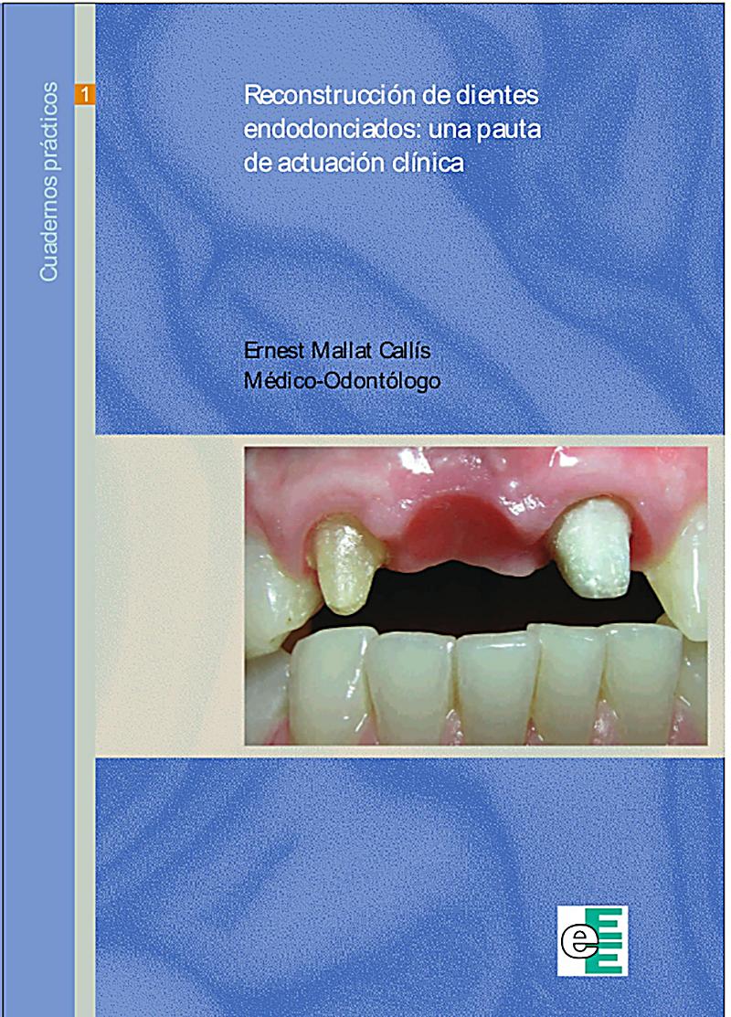 Reconstrucción de dientes endodonciados