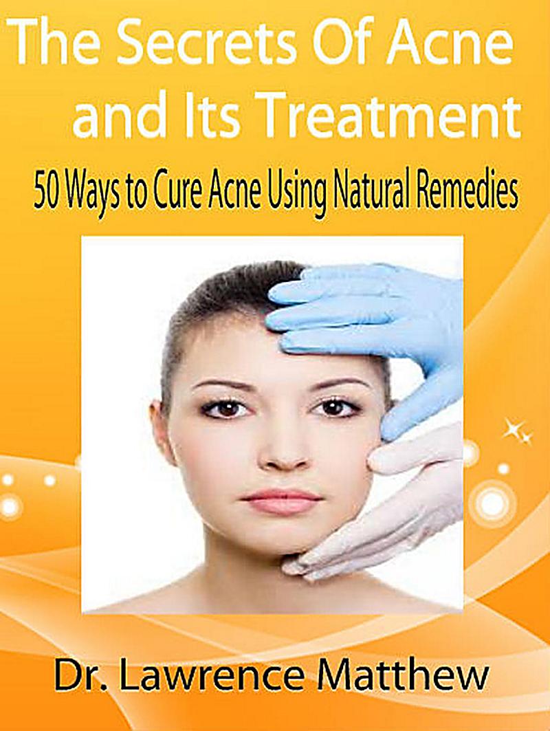 The Secrets of Acne and its Treatment - 50 Ways to Cure Acne Using Natural Remedies