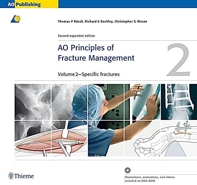 Ao principle of fracture management cd1cd2