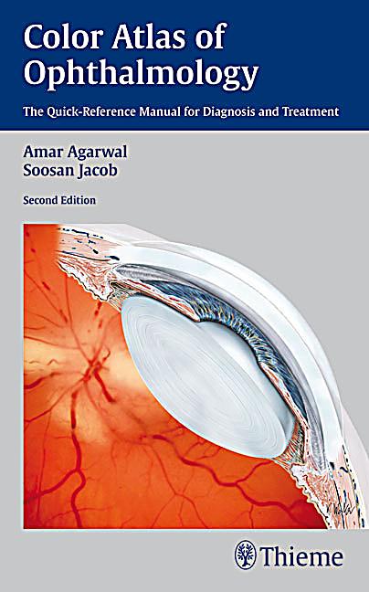 download how to develop robust solid oral dosage forms from conception to