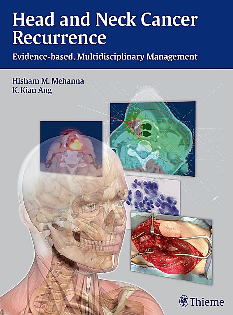 Head and Neck Cancer Recurrence Buch portofrei bei Weltbild.de