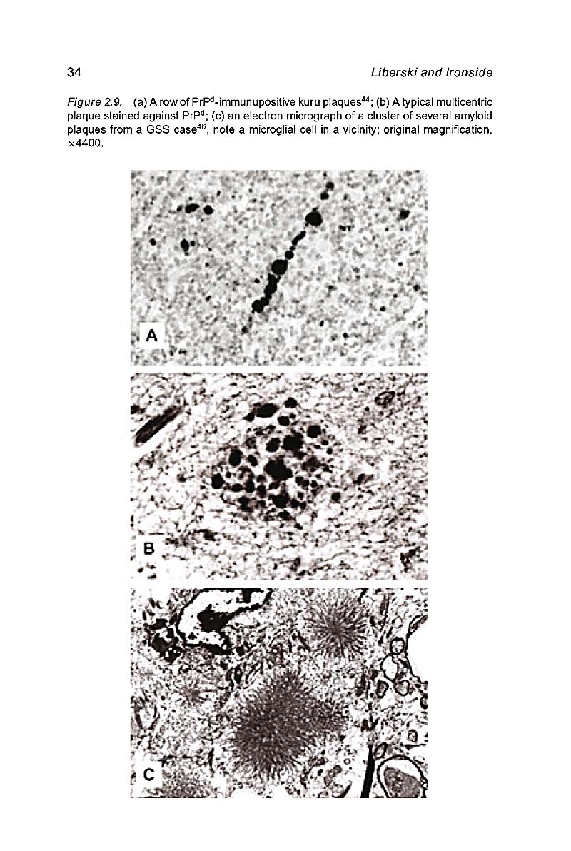 Neurodegeneration And Prion Disease Buch Portofrei