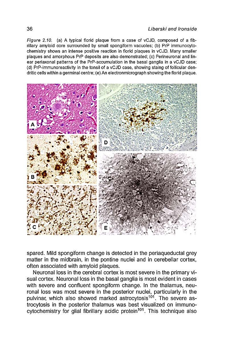 Neurodegeneration And Prion Disease Buch Portofrei