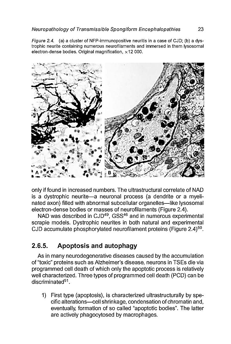 Neurodegeneration And Prion Disease Buch Portofrei