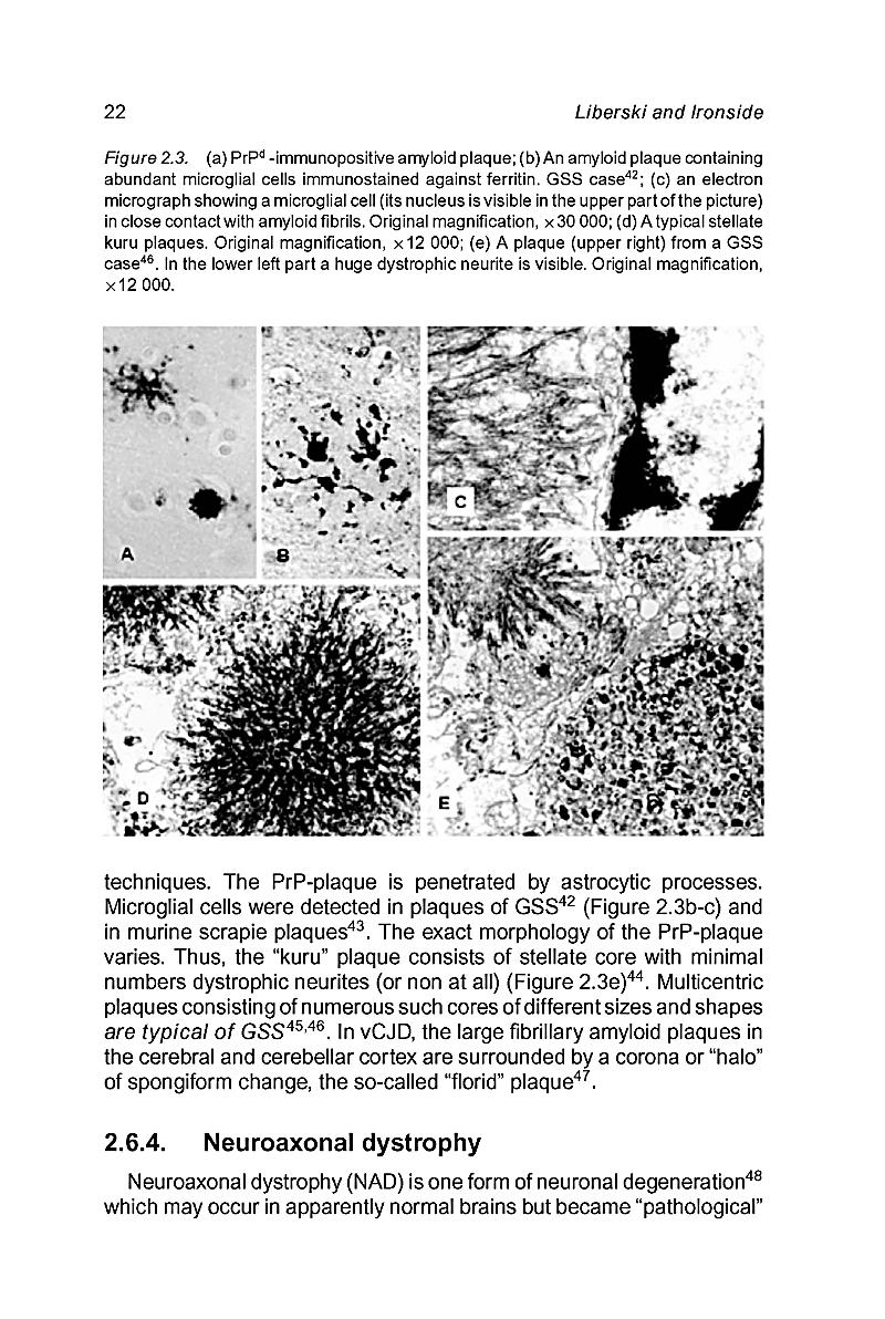 Neurodegeneration And Prion Disease Buch Portofrei