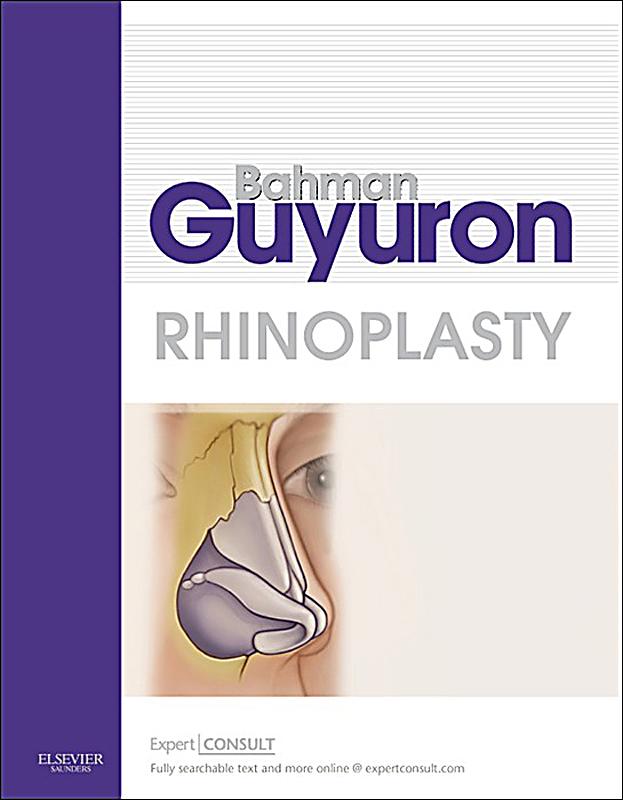 Dr bahman guyuron migraine surgery