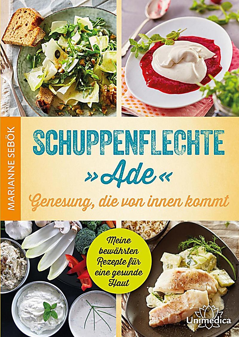 Natali stepanowoj die Behandlung der Schuppenflechte