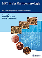 MRT in der Gastroenterologie - eBook - - -,