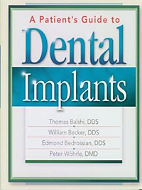 surface treatment of dental implants pdf