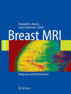 Breast Mri Diagnosis Intervention Pdf Converter
