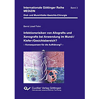 Infektionsrisiken von Allografts und Xenografts bei Anwendung im Mund-/Kiefer-/Gesichtsbereich? (Band 3) Infektionsrisiken von Allografts und Xenografts bei Anwendung im Mund-/Kiefer-/Gesichtsbereich? (Band 3)