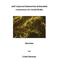Raft -Lipide und Cholesterol-Ester als Bestandteile von humanen ex vivo Amyloid-Fibrillen Raft -Lipide und Cholesterol-Ester als Bestandteile von humanen ex vivo Amyloid-Fibrillen