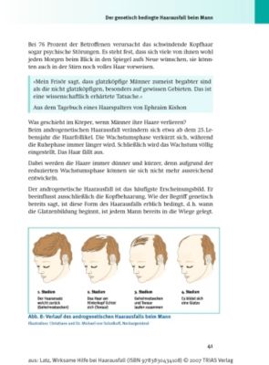 Wirksame Hilfe Bei Haarausfall Buch Portofrei Bei Weltbildde - 